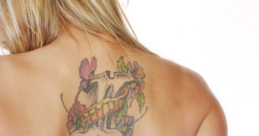 Lazerle Dövme Silme Tedavisi