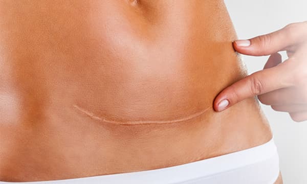 Özel Elos Lazer Polikliniği - 22. Fotoğraf Özel Elos Lazer Polikliniği - 22. Fotoğraf