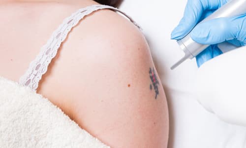 Özel Elos Lazer Polikliniği