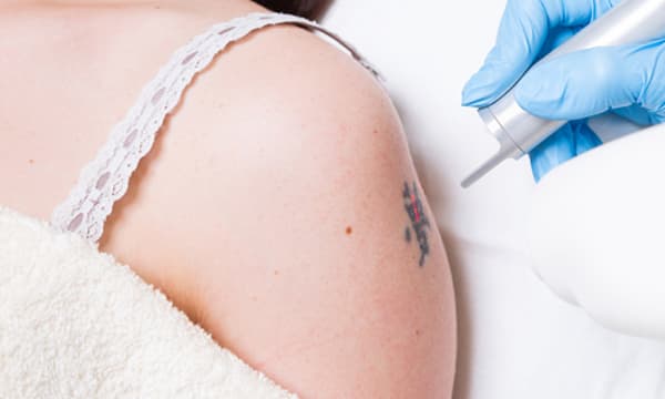 Özel Elos Lazer Polikliniği - 11. Fotoğraf Özel Elos Lazer Polikliniği - 11. Fotoğraf